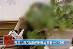 爆料美容视频,揭秘明星护肤秘诀与常见误区